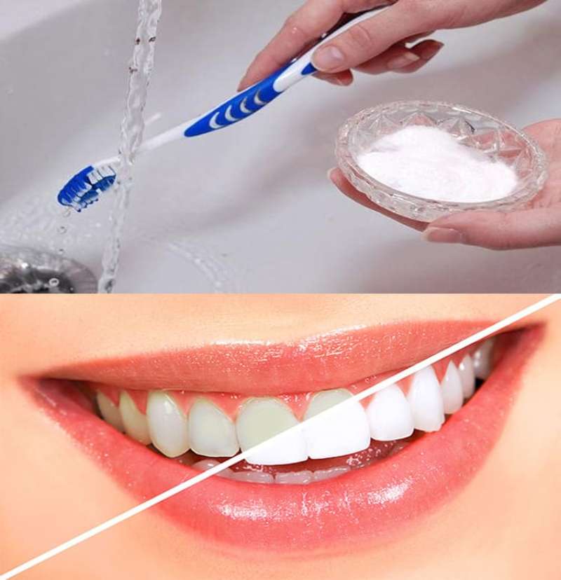 Muối ăn – “giải pháp” hoàn hảo trong việc làm trắng răng
